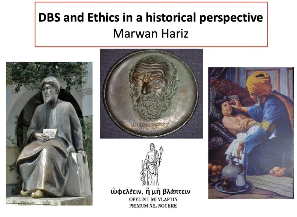 DBS and ethics in a historical perspective