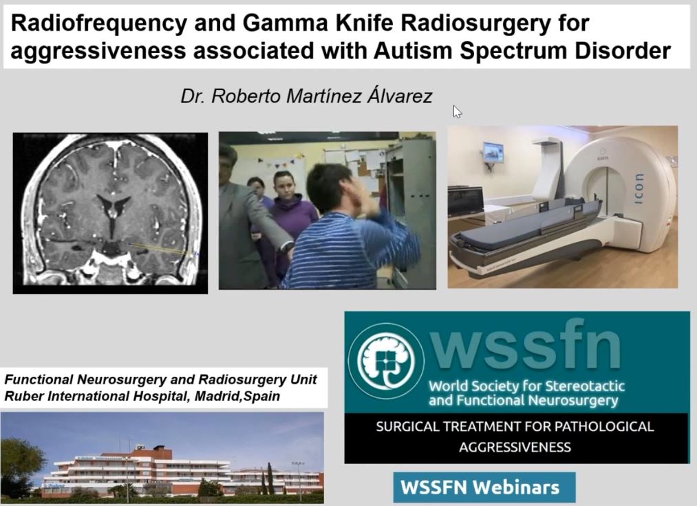 Surgical Treatment For Pathological Aggressiveness (Part II)