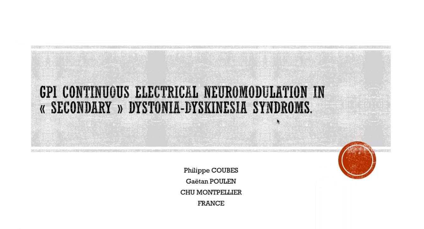 GPi Continuous Electrical Neuromodulation in Secondary Dystonia-Dyskinesia Syndrome